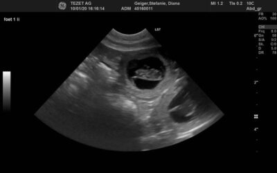 Cassy & Diana are pregnant!!!!